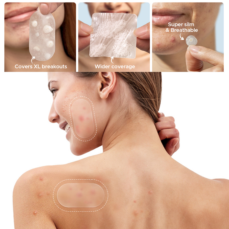 Beauty Of Makeup - New 116Pcs Invisible Anti-Acne Repair Patches