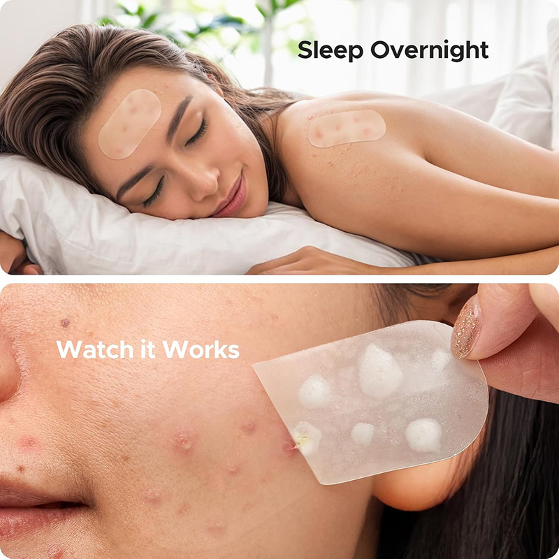 New 116Pcs Invisible Anti-Acne - Beauty Of Makeup reseña y precio