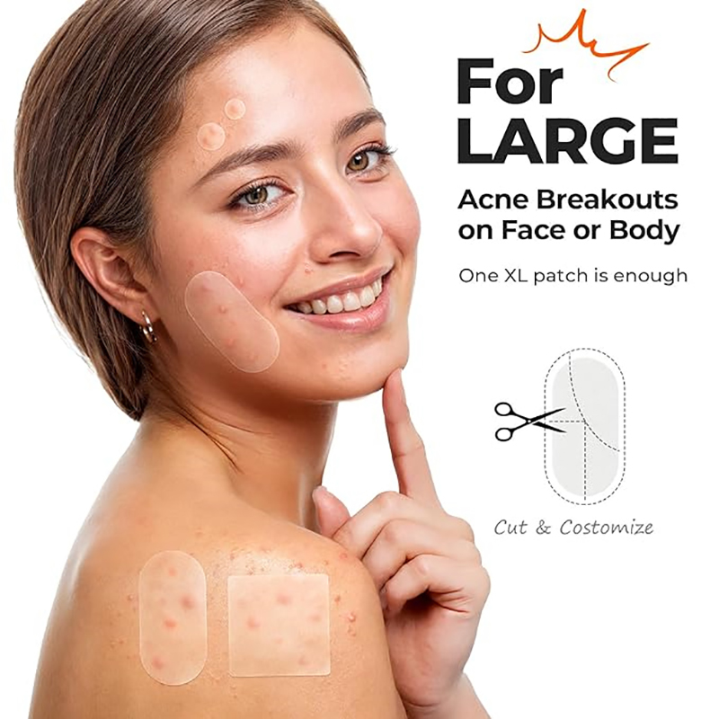 New 116Pcs Invisible Anti-Acne - Beauty Of Makeup reseña y precio